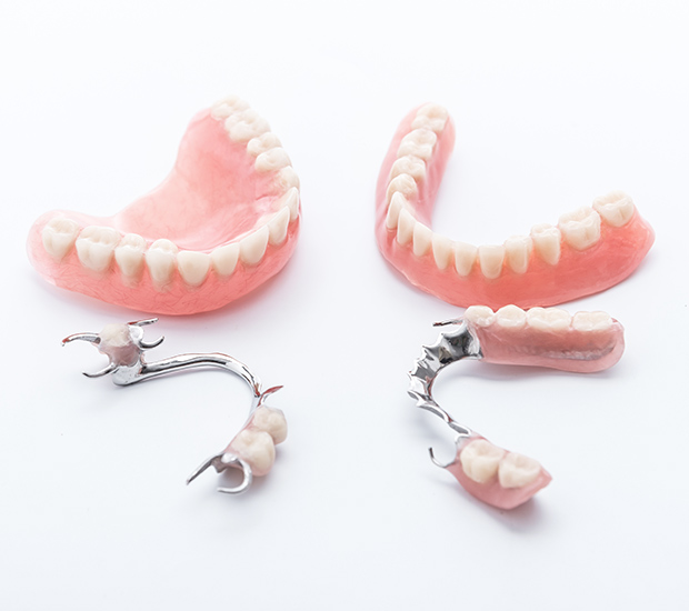 Anchorage Dentures and Partial Dentures