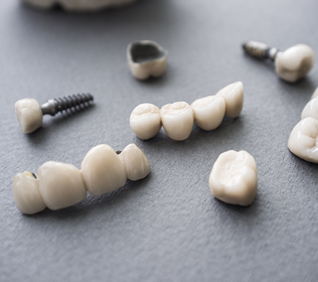 Anchorage The Difference Between Dental Implants and Mini Dental Implants