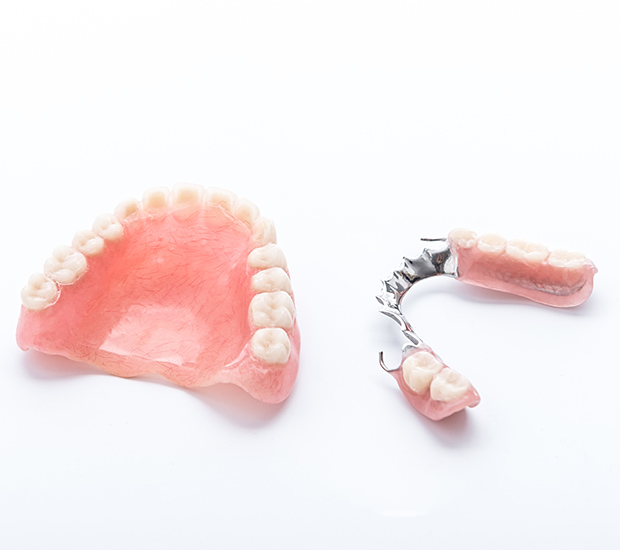 Anchorage Partial Dentures for Back Teeth